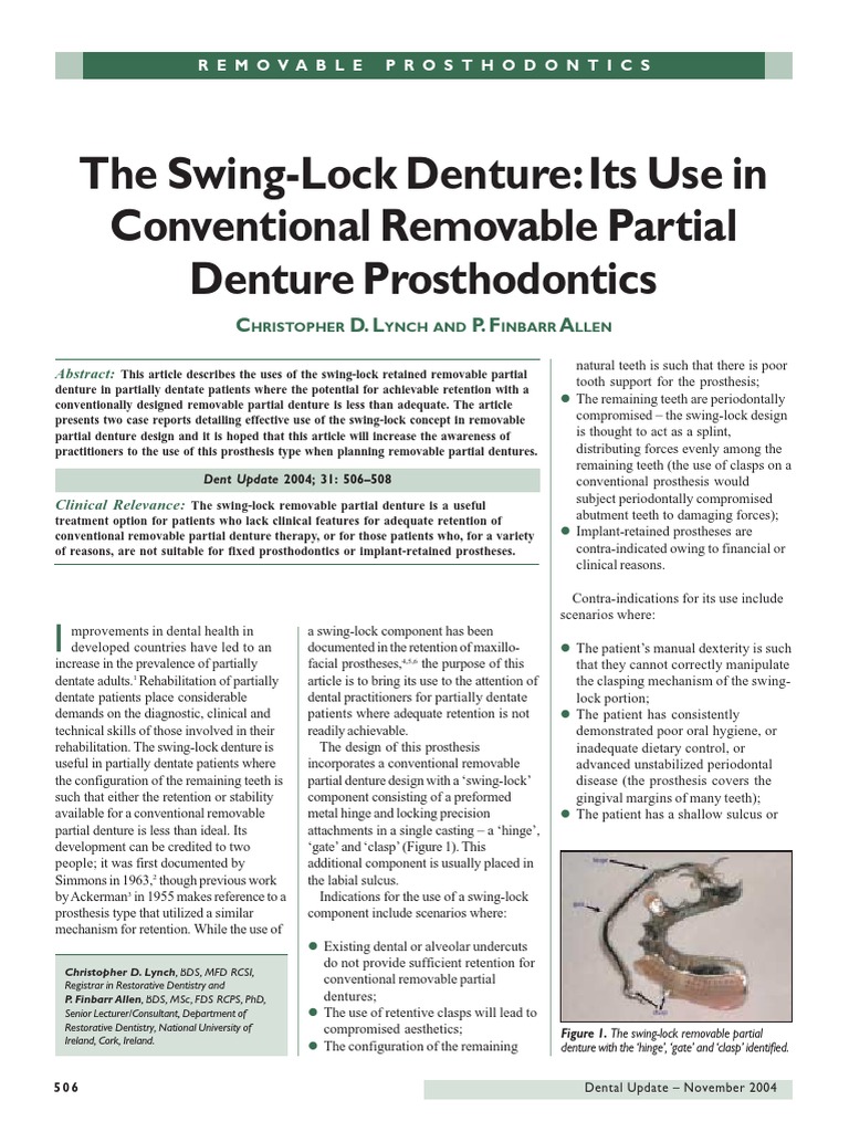 The Swing Lock Denture Its Use in Conventional Removable Partial