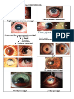 Diagram For Ophtal Note