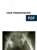 I. Dr. Noer. Case Fracture Pelvis