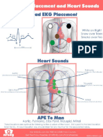 5 Lead EKG Placement