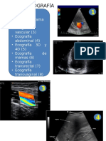Ecografía 