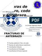 Fracturahumerocodoantebrazo