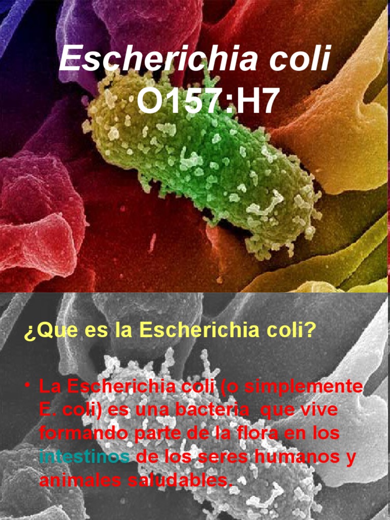 E. coli: Definición y Prevención | PDF | Escherichia coli | Epidemiología