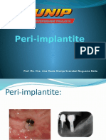 Peri-implantite Diagnóstico e Tratamento