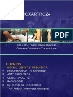 Coxartroza, Gonartroza