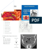 hsc rhinosinusitis