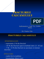 28.Fracturile Calcaneului - Dr.ouatu Constantin