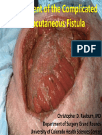 March 14 MGT of Complicated Enterocutaneous Fistulas DR Raeburn