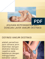 Asuhan Keperawatan Bayi Lahir Vakum Ekstraksi