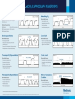 EMS Capnography Waveforms