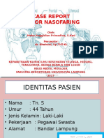 Case Report Tumor Nasofaring Meka Anggidian Primadina, S. Ked