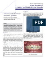 A Novel Approach to Intrude Incisor by Removable Orthodontic Appliance