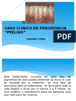 Caso Clinico de Periodoncia