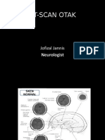 Ct-Scan Otak