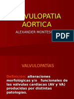 Valvulopatia Aortica