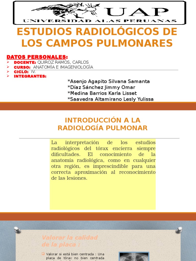 Campos Pulmonares Pulmón Anatomía