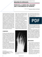 Osteocondritis