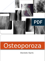Curs 16.1.osteoporoza Curs DO
