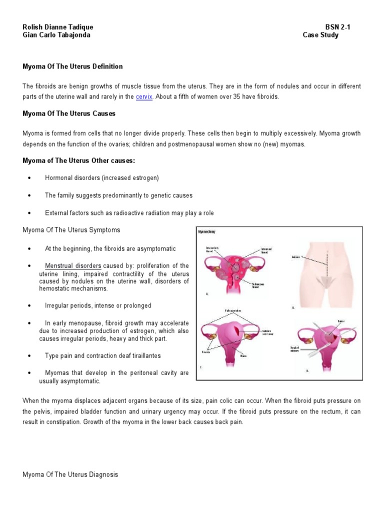 Myoma Case Study | PDF | Uterus | Menstrual Cycle