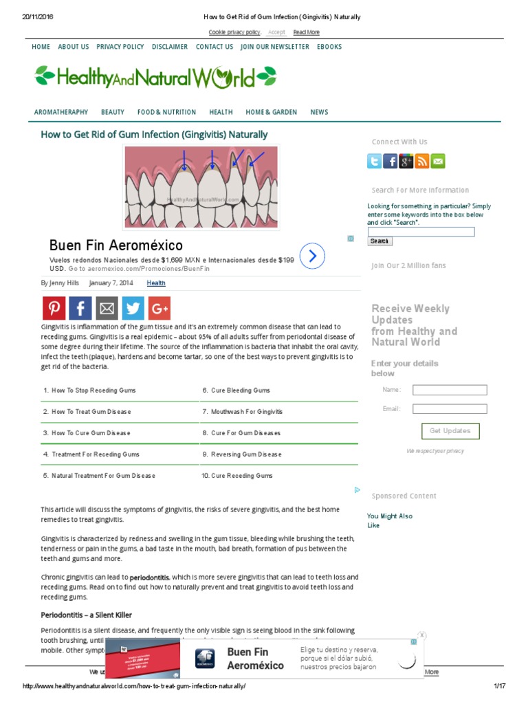 How To Get Rid of Gum Infection (Gingivitis) Naturally PDF Cardiovascular Diseases Antibiotics