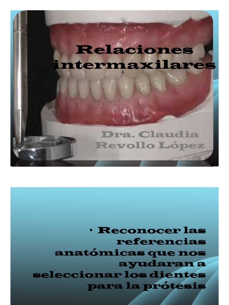 Relaciones Intermaxilares | PDF