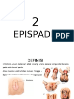 EPISPADIA