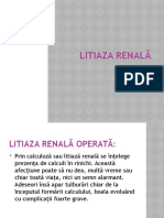 Litiaza Renala