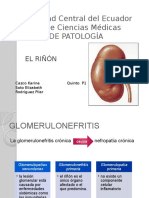 Glomerulonefritis