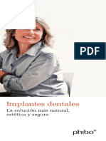 Los Implantes Dentales