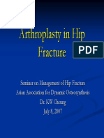 5 Arthroplasty Hip Fracture