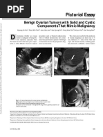 Benign Ovarian Tumors With Solid and Cystic Components That Mimic Malignancy