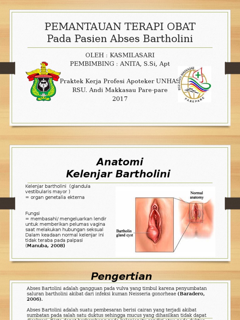 Ppt Kista Bartholini