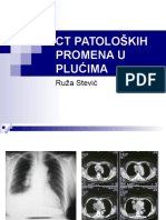 CT Pat. Promena U Plucima (R. Stevic)