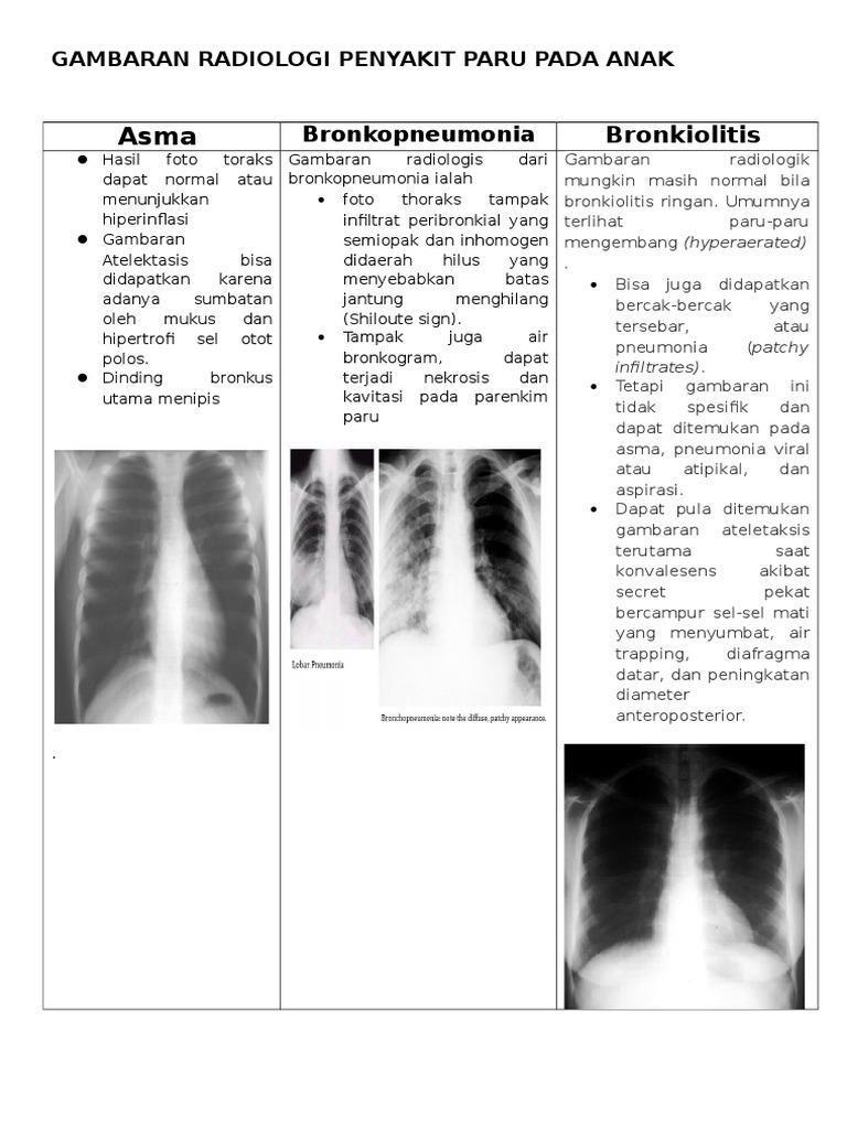 Gambaran Radiologi Penyakit Paru Anak | PDF