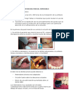 Control de La Dentadura Parcial Removible