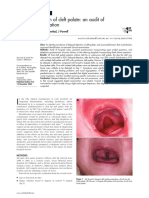 Delayed Detection of Cleft Palate: An Audit of Newborn Examination