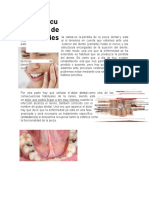 Consecuencias de Las Caries