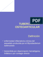 Tuberculosis Osea