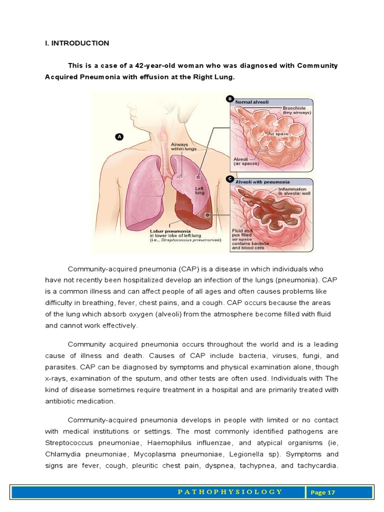 Community-Acquired Pneumonia Overview | PDF | Respiratory Tract | Pneumonia