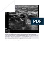 Normal Proximal Appendix Is Seen