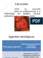 Cervicite pptx-1