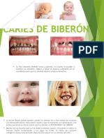 Caries de Biberon