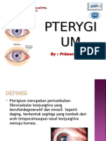 Pterygium New