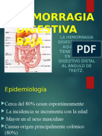 Hemorragia Digestiva Baja