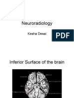 Neuroradiology: Kesha Desai