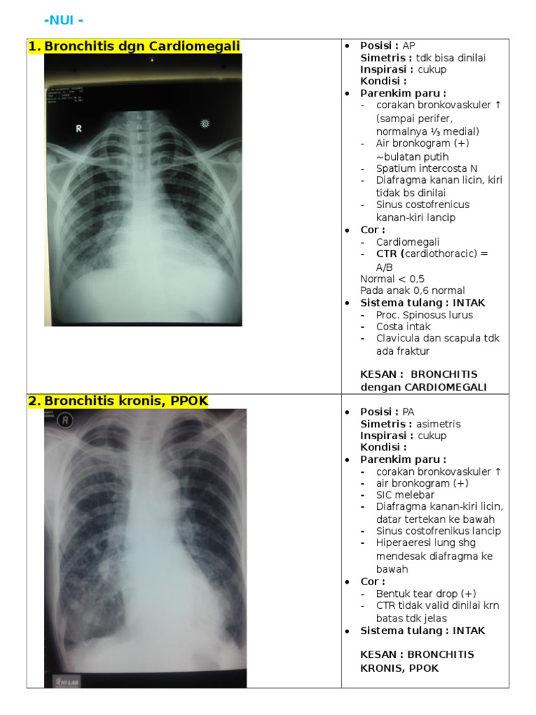 RADIOLOGI | PDF