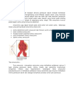 Aneurysma Aorta