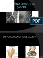 Displasia de Cadera