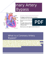 Coronary Artery Bypass