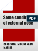 External Nose.pptx